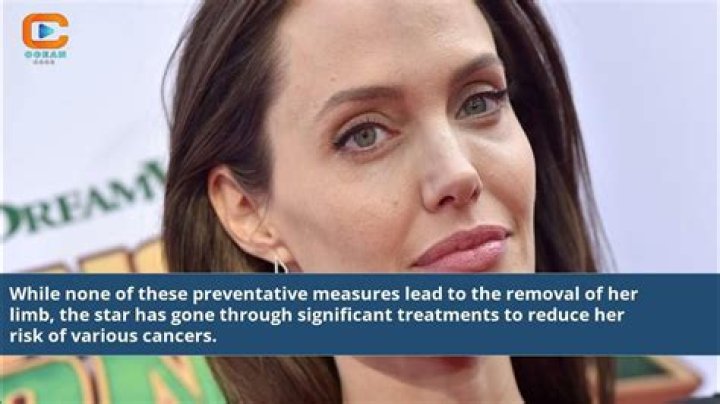 Did Angelina Jolie Lose A Leg