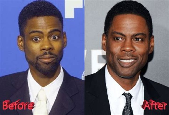 Has Chris Rock Had Plastic Surgery