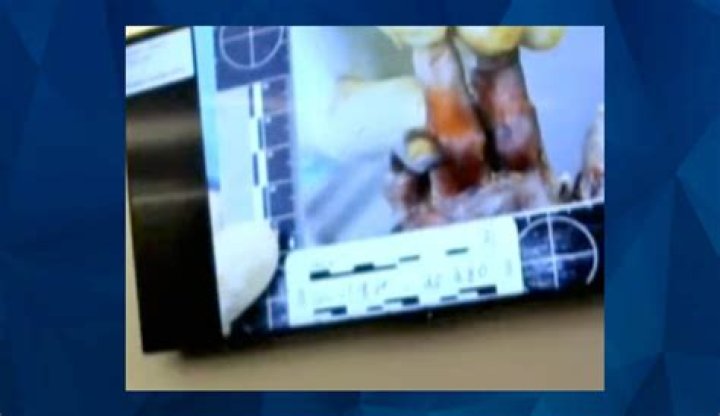 Unraveling The Jed Hall Autopsy Report