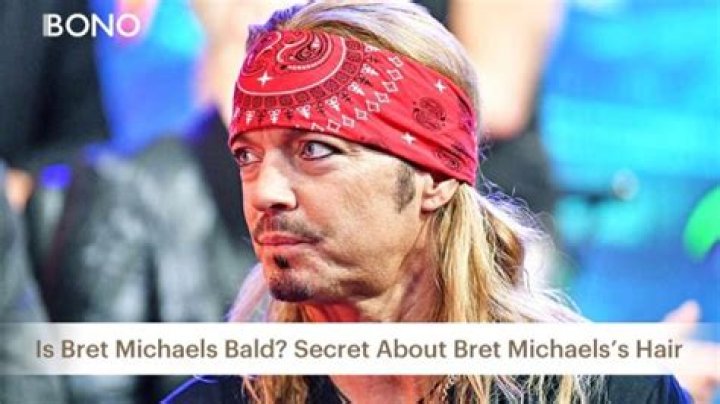 Unveiling Bret Michaels' Hair Loss Journey: Revelations And Breakthroughs