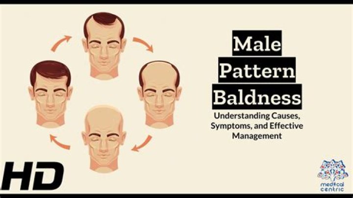 Unveiling The Power And Confidence Of Baldness