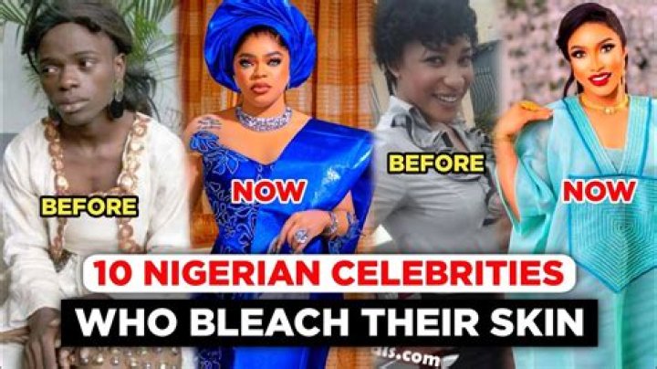 Unveiling The Truth: Celebrities With Bleached Skin